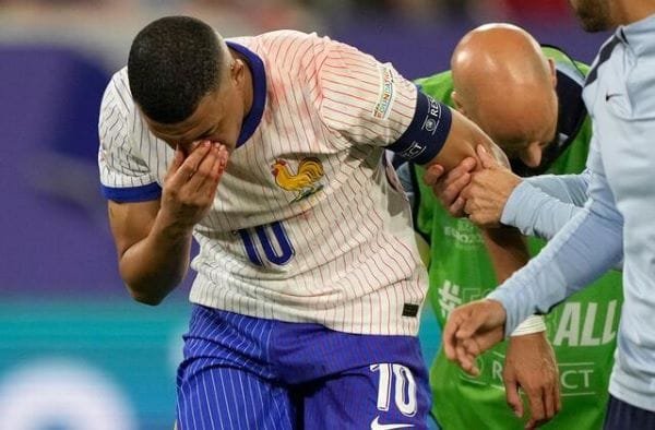 Cedera Kylian Mbappe Mengguncang Timnas Prancis di Euro 2024