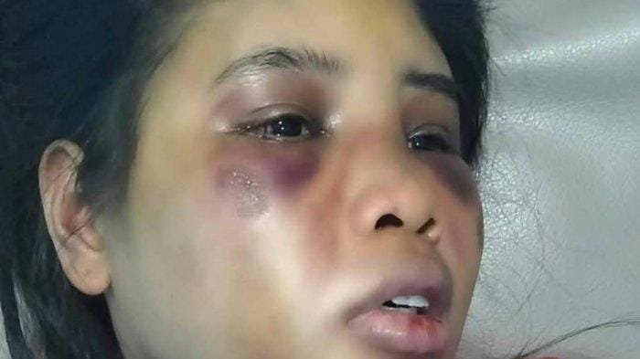 Polisi Tetapkan Dua Tersangka dalam Kasus Penganiayaan ART di Batam